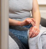 Person applying soothing cream to skin rashes, common signs of lupus.