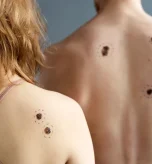 Common markings on skin to help identify 3 types of skin cancer.