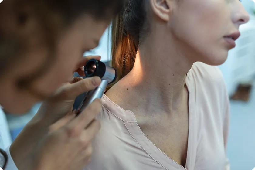 Dermatologist using a dermatoscope for an accurate and professional skin cancer diagnosis.