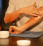 Applying cream to poison ivy rash pics showing inflamed arm skin irritation pictures of poison ivy