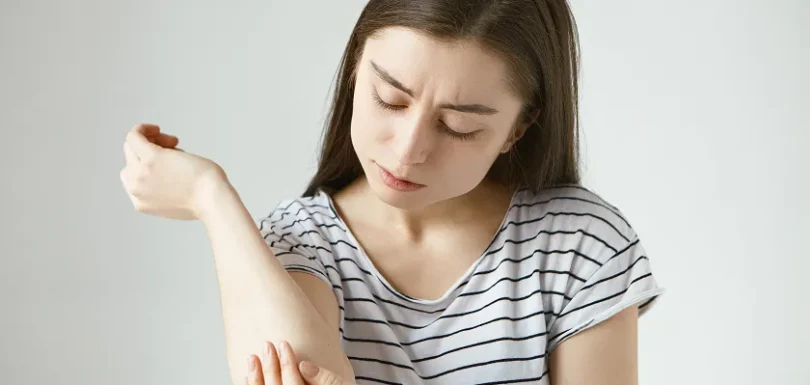 Woman scratching arm due to allergic reaction to wasp sting, yellow jacket allergy possible.