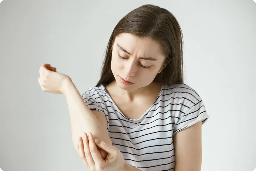 Woman scratching arm due to allergic reaction to wasp sting, yellow jacket allergy possible.
